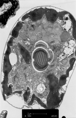 Electron micrograph of the dinoflagellate Amphidinium carterae, one of the most widely used lab strains.