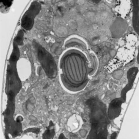 Electron micrograph of the dinoflagellate Amphidinium carterae, one of the most widely used lab strains.