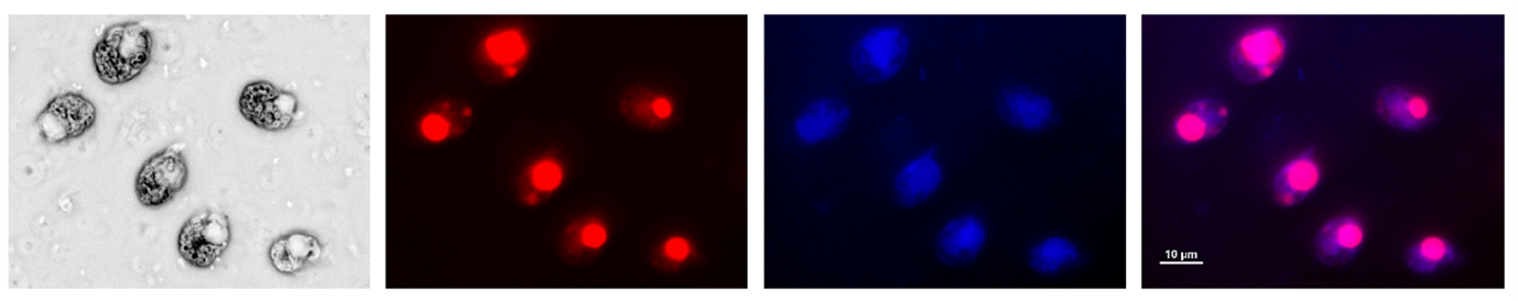 Expression of chloramphenicol acetyl transferase (CAT) in genetically modified dinoflagellate chloroplasts.